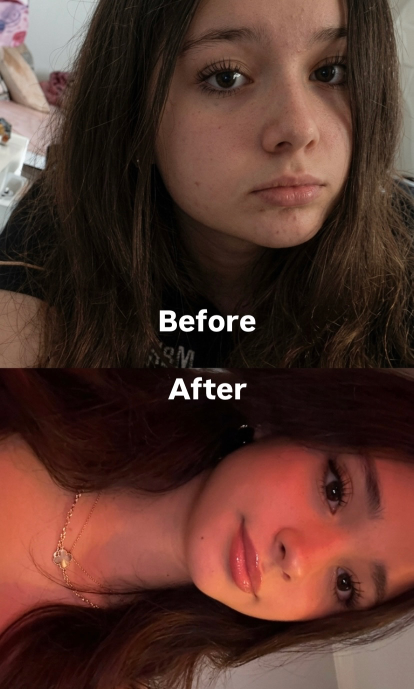 How I Lost Face Fat, Fixed My Skin & Glowed Up in 14 Days